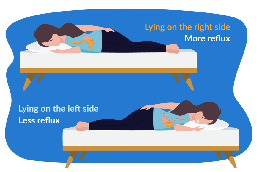 acid reflux when lying down